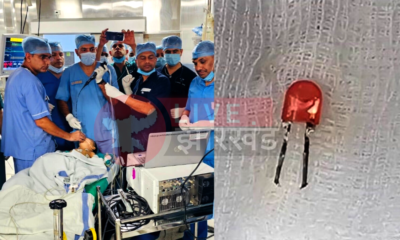 Pune News: 9 महीने के बच्चे के फेफड़े में फंसा LED बल्ब, आर्मी डॉक्टरों ने बचाई मासूम की जान