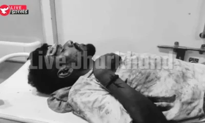 Jamshedpur News: जेम्को बाजार में युवक पर जानलेवा हमला, 20 से 25 लोगों ने घेरकर किया वार; हालत गंभीर