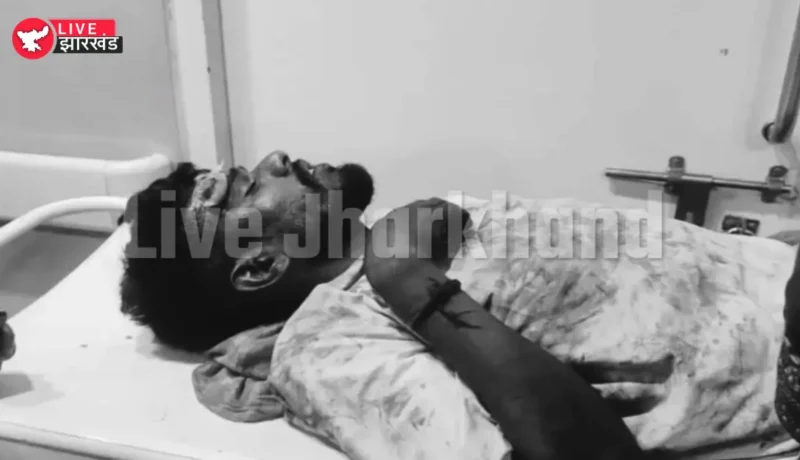Jamshedpur News: जेम्को बाजार में युवक पर जानलेवा हमला, 20 से 25 लोगों ने घेरकर किया वार; हालत गंभीर